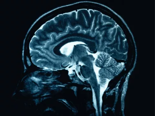 Des chercheurs lyonnais ont identifié la "voix" du cerveau