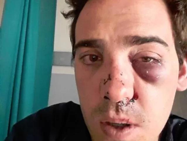 Lyon : les avocats d'Alexandre, tabassé pour avoir défendu UBER, cherchent des témoins