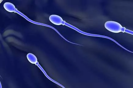Une soci&eacute;t&eacute; lyonnaise annonce la premi&egrave;re cr&eacute;ation de spermatozo&iuml;des in vitro