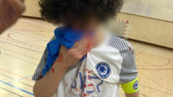 Un match de futsal U18 vire à la bagarre générale à Rillieux-la-Pape : de nombreux adolescents blessés Un match de futsal U18 vire à la bagarre générale à Rillieux-la-Pape : de nombreux adolescents blessés