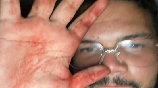 Un an après l’agression de Bassem à Vénissieux, Sadek toujours libre