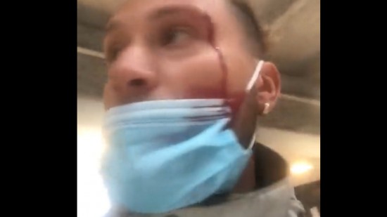 Le leader de la Jeune Garde Lyon agressé par des membres de l'ultradroite à Paris