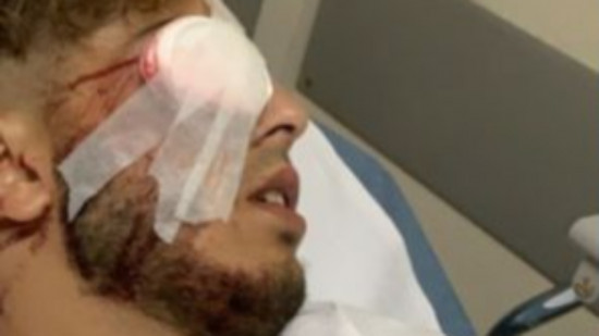 Supporter de l&rsquo;Alg&eacute;rie &eacute;borgn&eacute; &agrave; Lyon : la responsabilit&eacute; de l&rsquo;Etat non retenue