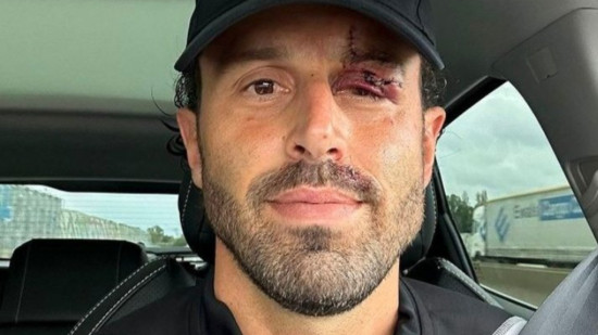 Olympico : 30 jours d'ITT pour Fabio Grosso, aucune interpellation pour le caillassage du bus de l'OL