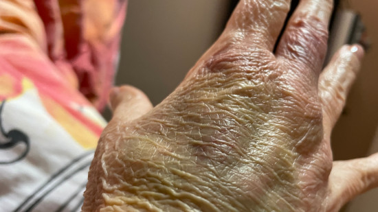 "Pendant que l’une me tapait, l’autre volait" : une septuagénaire en état de choc après avoir été agressée chez elle à Villeurbanne "Pendant que l’une me tapait, l’autre volait" : une septuagénaire en état de choc après avoir été agressée chez elle à Villeurbanne