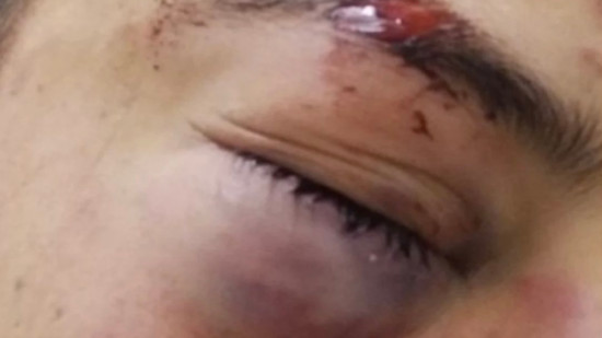 Prison avec sursis pour avoir participé à l'agression de militants LFI à Lyon : "La violence fasciste reste impunie"