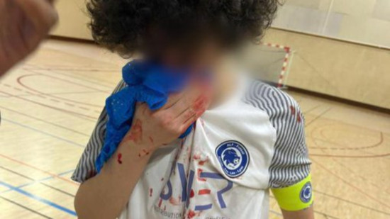 Un match de futsal U18 vire &agrave; la bagarre g&eacute;n&eacute;rale &agrave; Rillieux-la-Pape : de nombreux adolescents bless&eacute;s