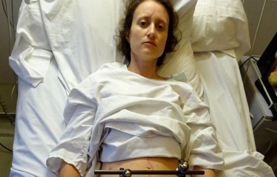 Amput&eacute;e des deux jambes, Caroline lance un appel aux dons