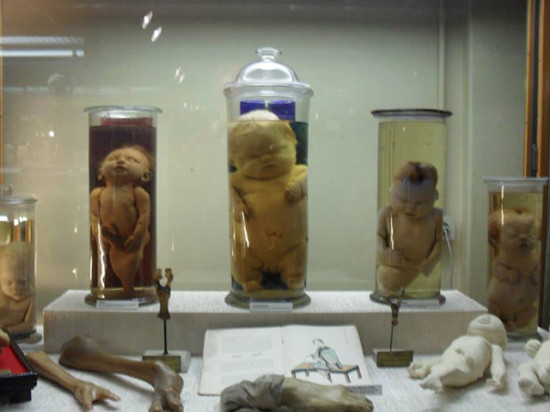 Il avait tenté de vendre sur Internet son butin du musée Testut-Latarjet Il avait tenté de vendre sur Internet son butin du musée Testut-Latarjet