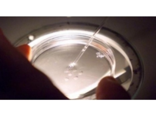 Une Lyonnaise contre l'anonymat des dons de sperme Une Lyonnaise contre l'anonymat des dons de sperme