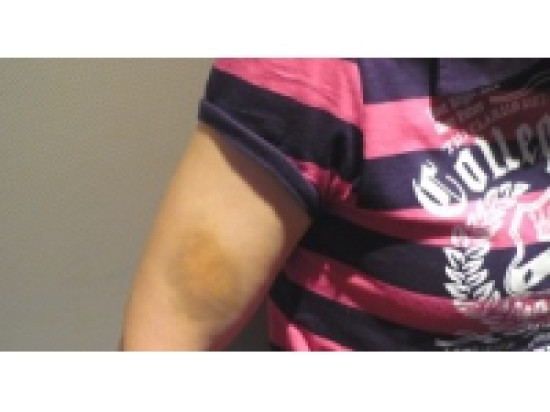 Saint-Valentin : un &eacute;v&eacute;nement contre les violences faites aux femmes &agrave; Lyon