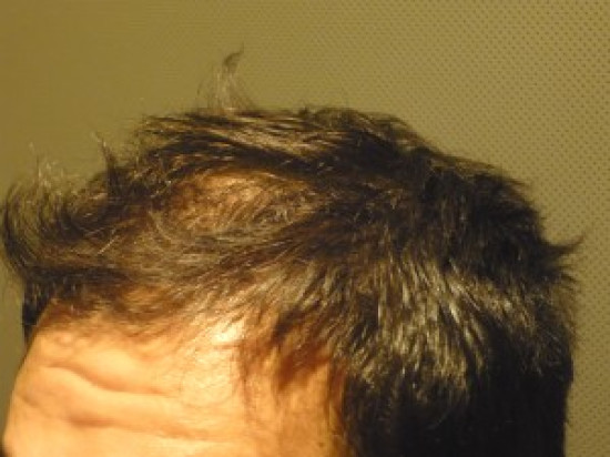 Un Lyonnais au Mondial de coiffure &agrave; Paris