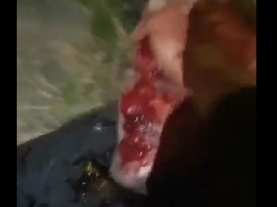 Vénissieux : Bassem Braiki violemment frappé par le rappeur Sadek