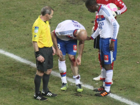 OL : Cris va manquer la finale de la Coupe de la Ligue