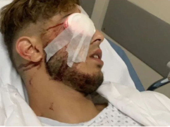 Lyon : un supporter de l’Algérie perd un œil à cause d’un tir de LBD ?