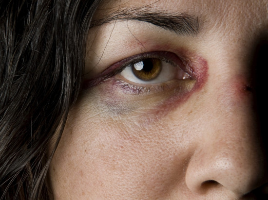 Violences conjugales : le Rhône compte le plus de décès