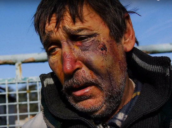 Agression de l’opposant au Grand Stade : deux suspects mis en examen