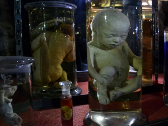 Lyon : il vole un foetus conservé au Musée d'anatomie Lyon : il vole un foetus conservé au Musée d'anatomie