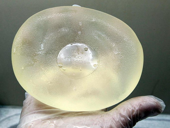 Proth&egrave;ses mammmaires : une victime lyonnaise de PIP gagne son proc&egrave;s &agrave; Lyon