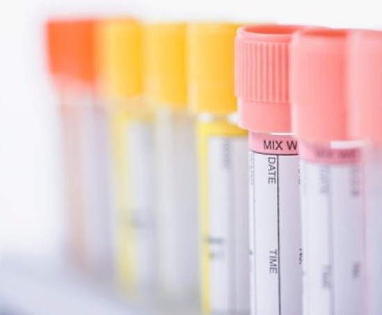 Don du sperme : le demande d’une Lyonnaise sur la levée de l’anonymat rejetée