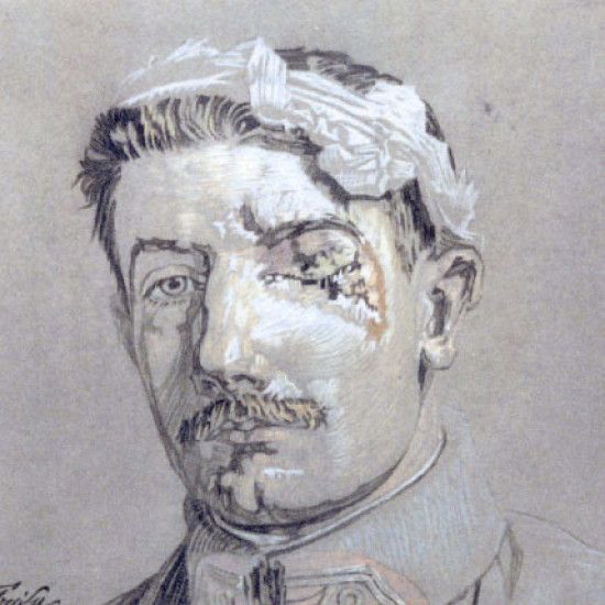 14-18 : le musée des HCL rend hommage aux "gueules cassées"