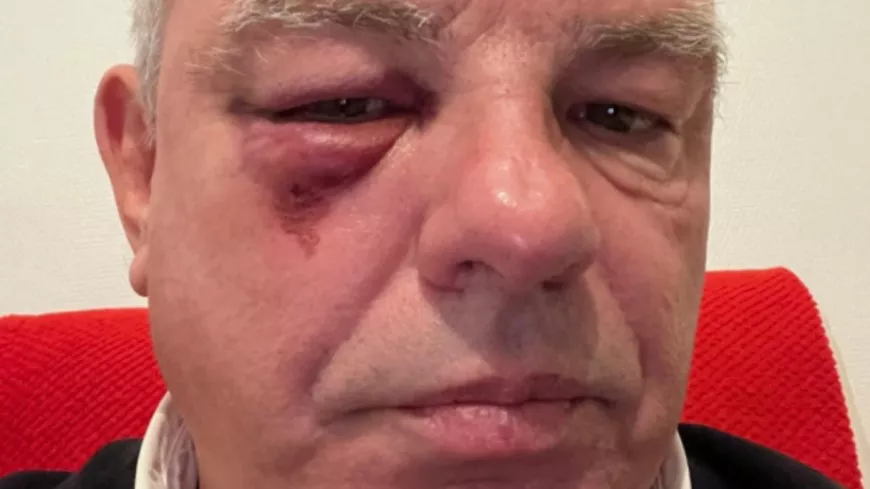 Un maire isérois agressé avec sa fille par des nationalistes