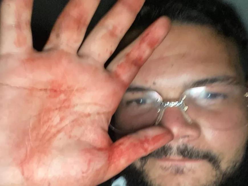 Agression de Bassem Braiki : des appels à la vengeance fleurissent sur les réseaux sociaux