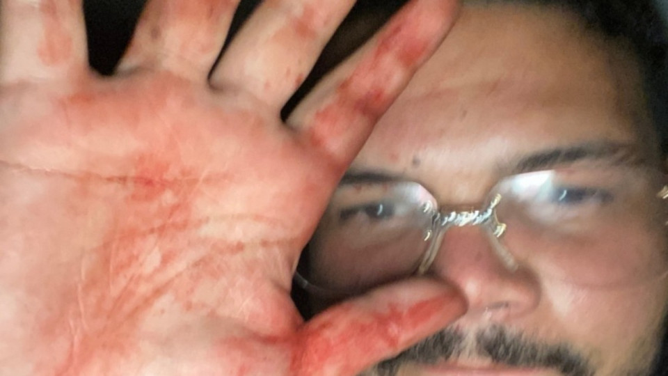 Un an après l’agression de Bassem à Vénissieux, Sadek toujours libre