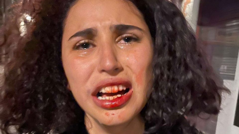 Dans la région : des TIG pour les antifas qui avaient passé à tabac des membres de l'UNI