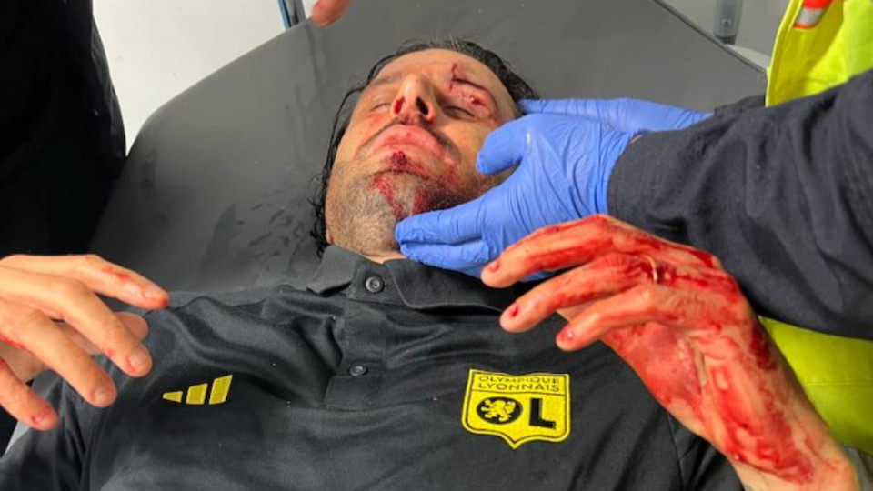 OM-OL : la rencontre ne se jouera pas après le caillassage du bus lyonnais !