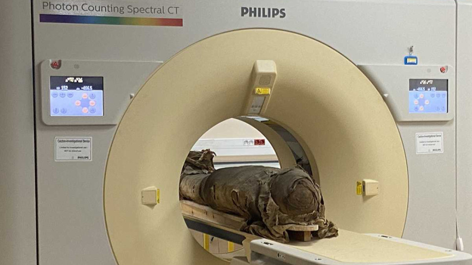 Vieille de 3 000 ans, la momie Séramon passe un scanner à Lyon