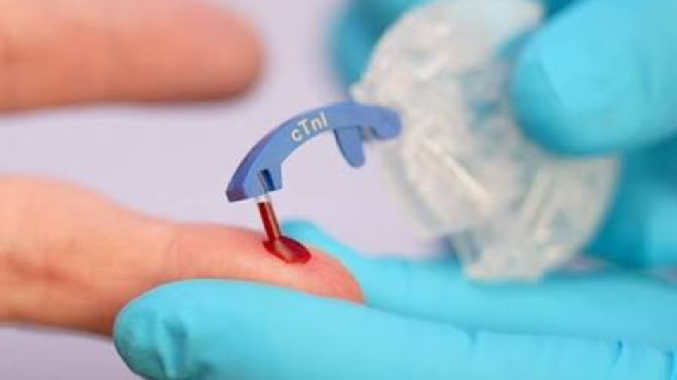 &Agrave; Marcy-l&rsquo;&Eacute;toile, bioM&eacute;rieux lance un test capable d&rsquo;aider &agrave; d&eacute;tecter un infarctus en 10 minutes