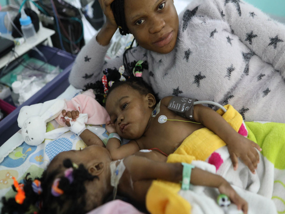 Lyon : les deux jumelles camerounaises opérées ont pu passer Noël ensemble