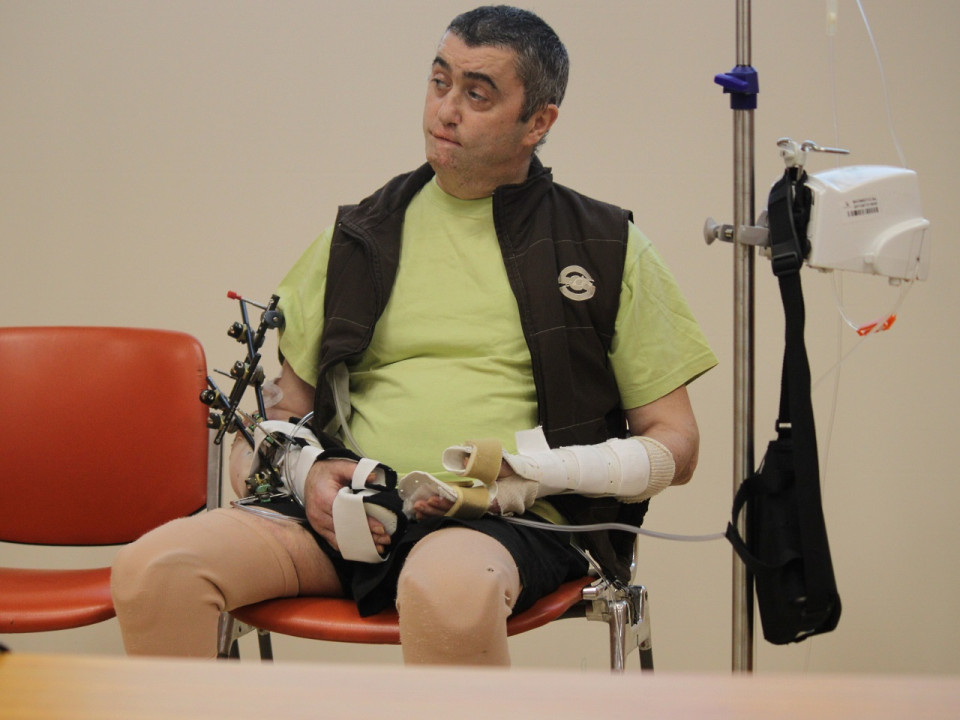 Nouvelle double greffe de mains à Lyon : "Je suis un homme comblé"