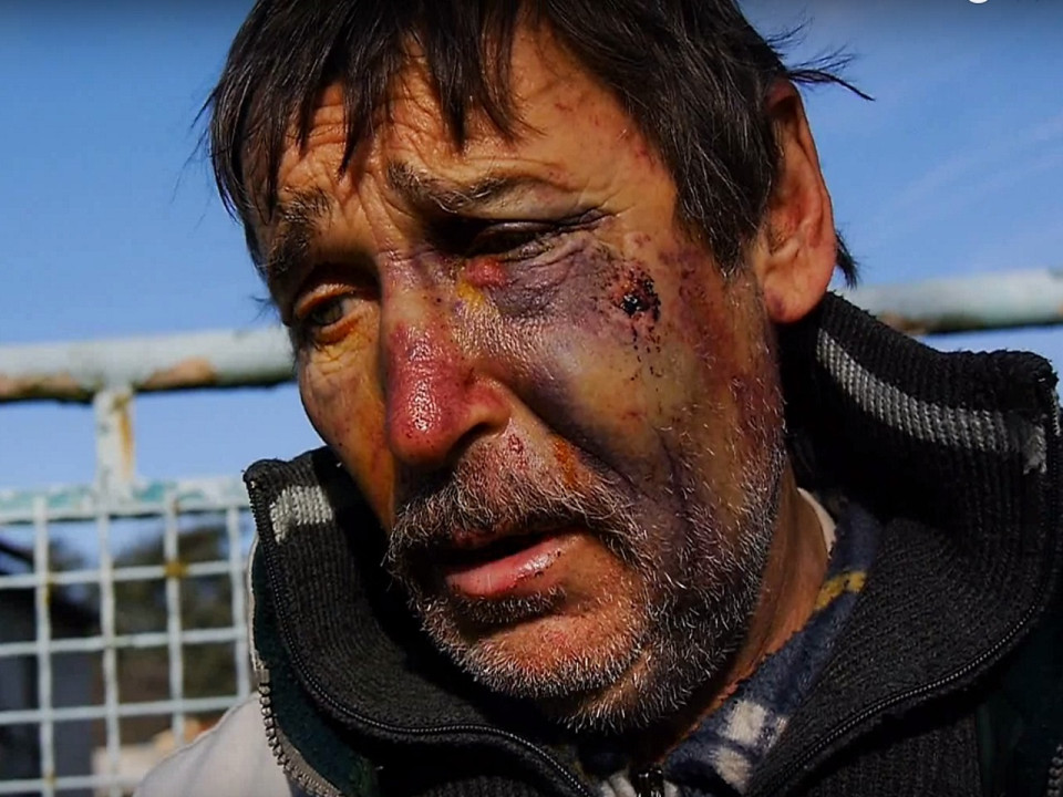 Agression de l’opposant au Grand Stade : deux suspects mis en examen